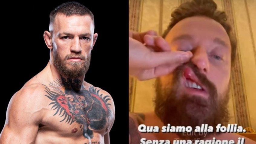 DJ italiano publica vídeo com marcas de uma suposta agressão de Conor McGregor: ‘Violento e perigoso’ DJ italiano publica vídeo com marcas de uma suposta agressão de Conor McGregor: ‘Violento e perigoso’