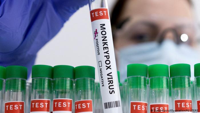 Argentina confirma 1ºs casos de varíola na América Latina