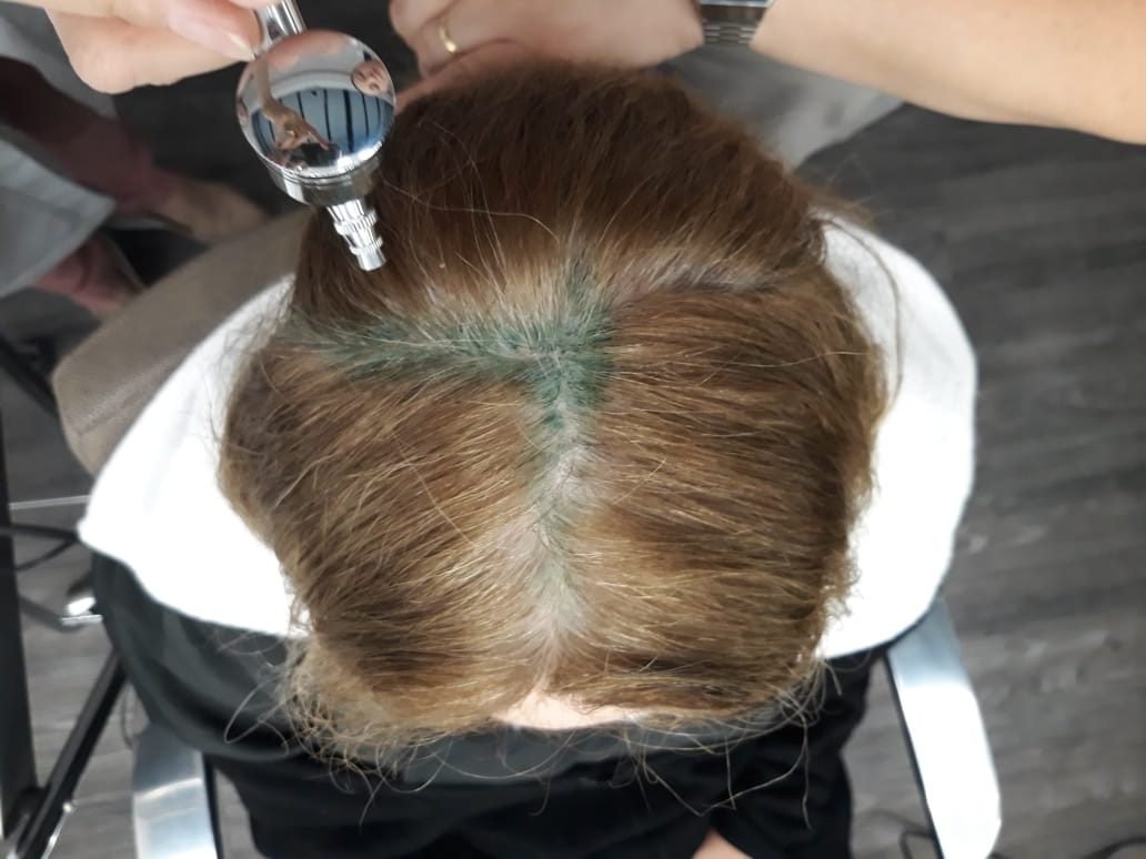 Como fazer o cabelo crescer: 3 tratamentos inovadores - ISTO&Eacute; Independente